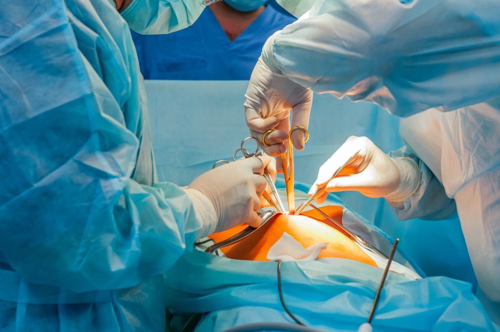 surgical operation process using laparoscopic equipment in the modern clinic.